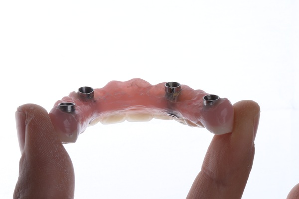 How Long Does It Take To Get Implant Supported Dentures?
